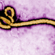 Illustration for article titled Welcome to America, Ebola!!!!!